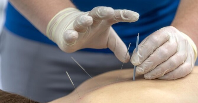 How Can an Acupuncture Clinic Create a More Personalized Treatment Experience?