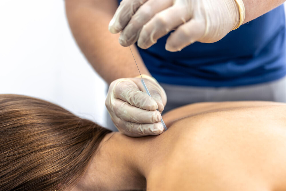Neurofunctional Medical Acupuncture  Powerful Pain Relief