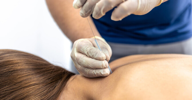 Neurofunctional Medical Acupuncture | Powerful Pain Relief image